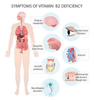 vitamin b2 deficiency